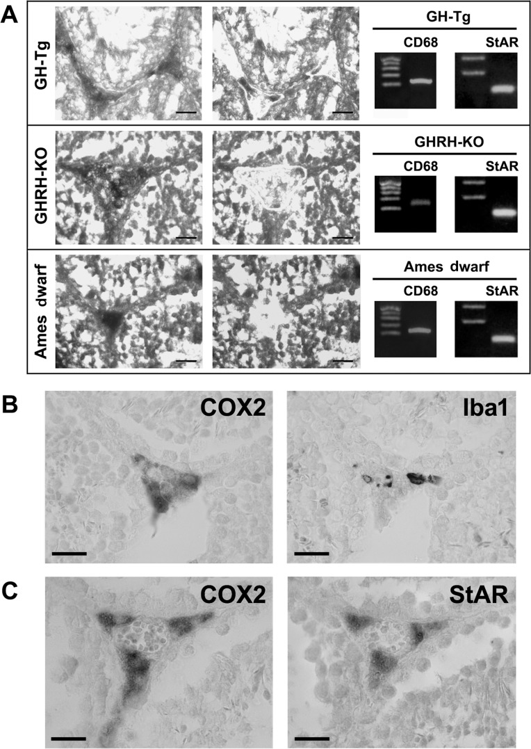COX2 is expressed in testicular macrophages and Leydig cells