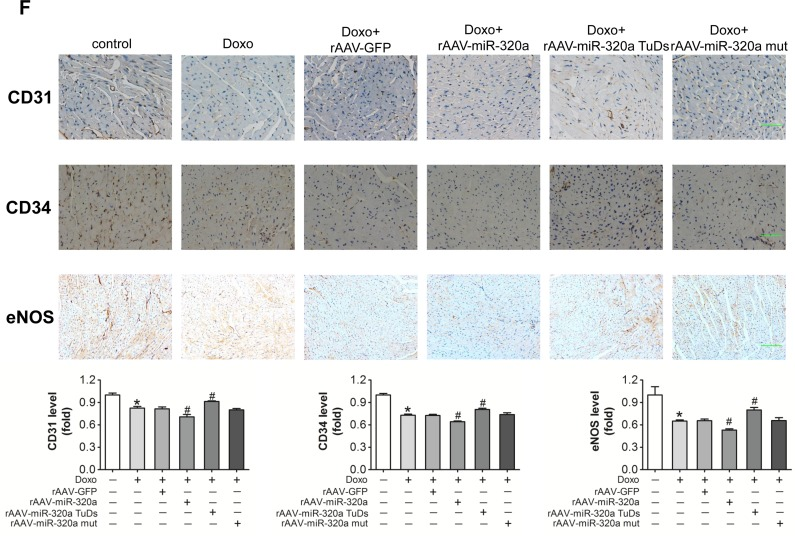 Inhibition of miR-320a improved cardiac dysfunction and cardiac microvessel injury induced by doxorubicin