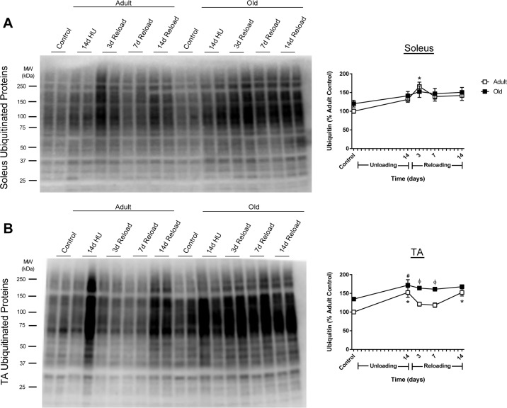 Total ubiquitin levels in adult and old rats after hindlimb unloading (HU) and reloading
