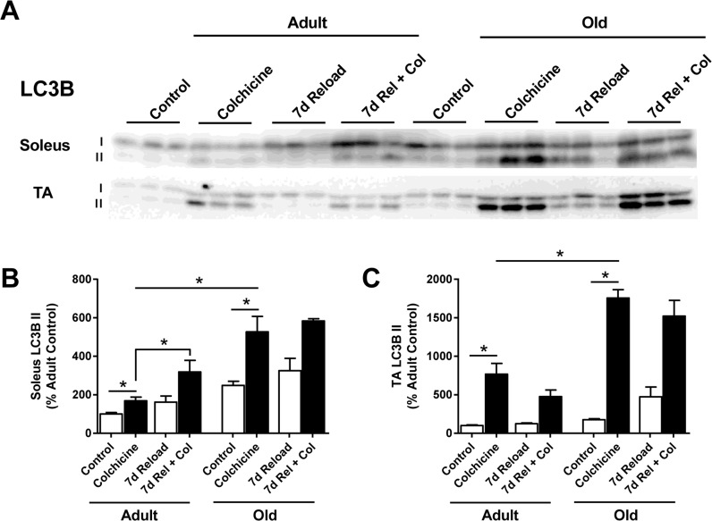 Effect of age and reloading on autophagic flux and p62 protein accumulation using the autophagy inhibitor colchicine