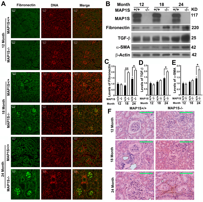 Depletion of MAP1S causes accumulation of fibronectin and renal fibrosis in aged mice