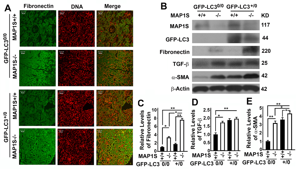 Autophagy defects triggered by MAP1S deficiency cause accumulation of fibronectin in mouse renal tissues