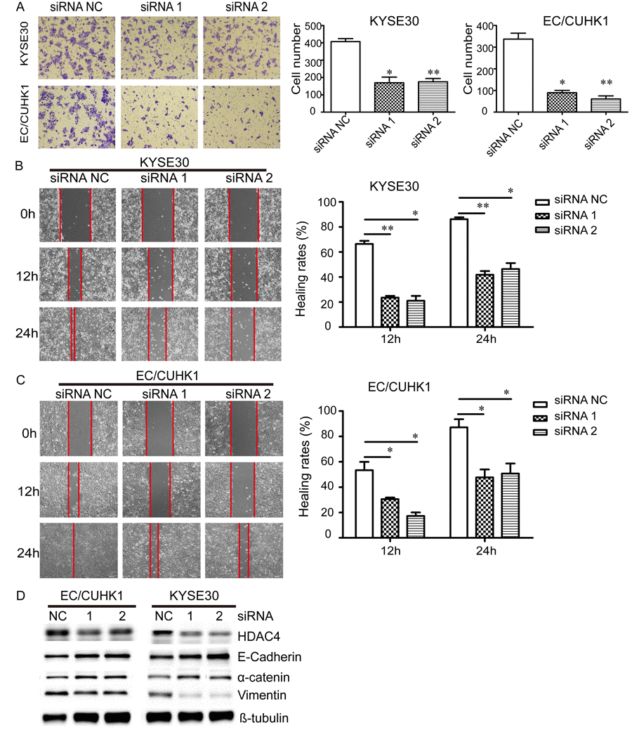 Down-regulation of HDAC4 inhibits the migration of EC cells