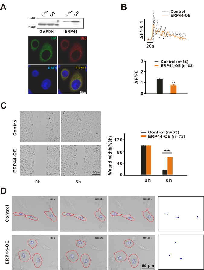 ERP44 inhibits cell migration by reducing intracellular Ca2+ release