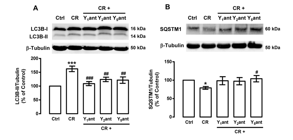 NPY receptor antagonists inhibit the stimulatory effect of caloric restriction on autophagy in rat cortical neurons. Primary rat cortical neurons were incubated with NPY Y1 receptor antagonist BIBP3226 (Y1ant, 1 μM), NPY Y2 receptor antagonist BIIE0246 (Y2ant, 1 μM) or NPY Y5 receptor antagonist L152,800 (Y5ant, 1 μM), 30 min before caloric restriction medium (CR) for 6 h. Whole cell extracts were assayed for LC3B-II (A), SQSTM1 (B) and β-tubulin (loading control) immunoreactivity by Western blotting analysis, as described in Materials and Methods. Representative Western blots for each protein are presented above each respective graph. The results represent the mean ± SEM of, at least, five independents experiments, and are expressed as percentage of control. *p#p##p###p