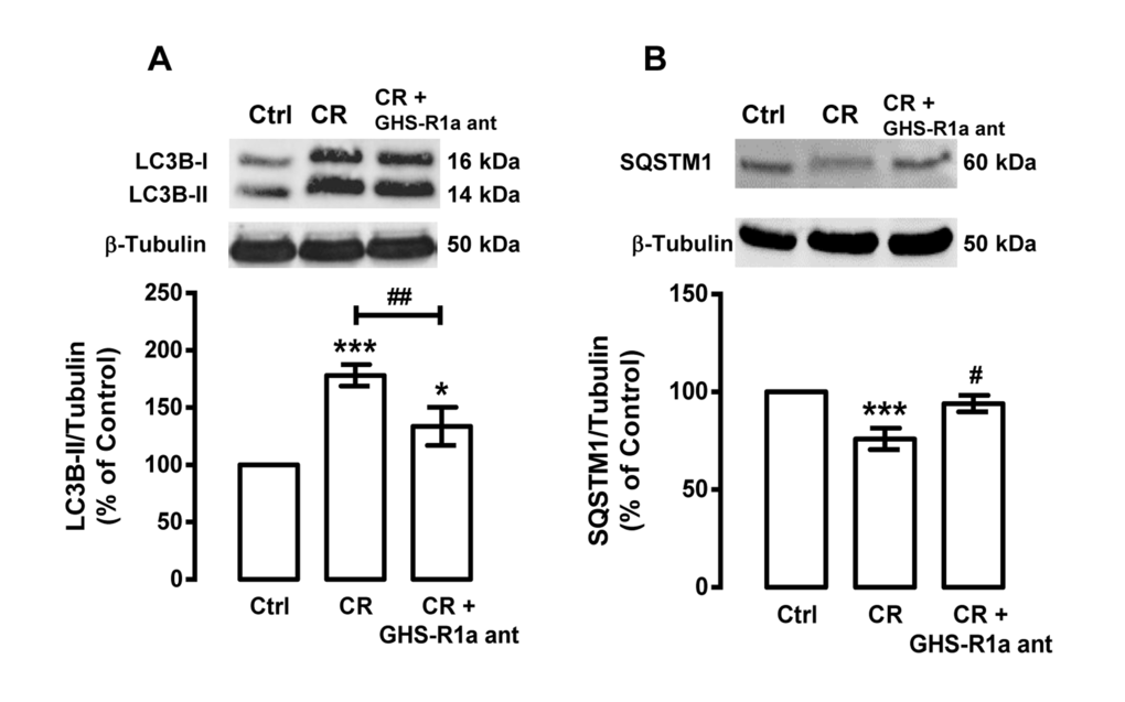 Ghrelin mediates caloric restriction-induced autophagy in rat cortical neurons. Primary rat cortical neurons were treated with GHS-R1a receptor antagonist [D-Lys3]-GHRP-6 (GHS-R1a ant, 100 μM) 30 min before caloric restriction (CR) for 6 h. Whole cell extracts were assayed for LC3B-II (A), SQSTM1 (B) and β-tubulin (loading control) immunoreactivity through Western blotting analysis, as described in Materials and Methods. The results represent the mean ± SEM of, at least, five independents experiments, and are expressed as percentage of control. *p#p##p###p