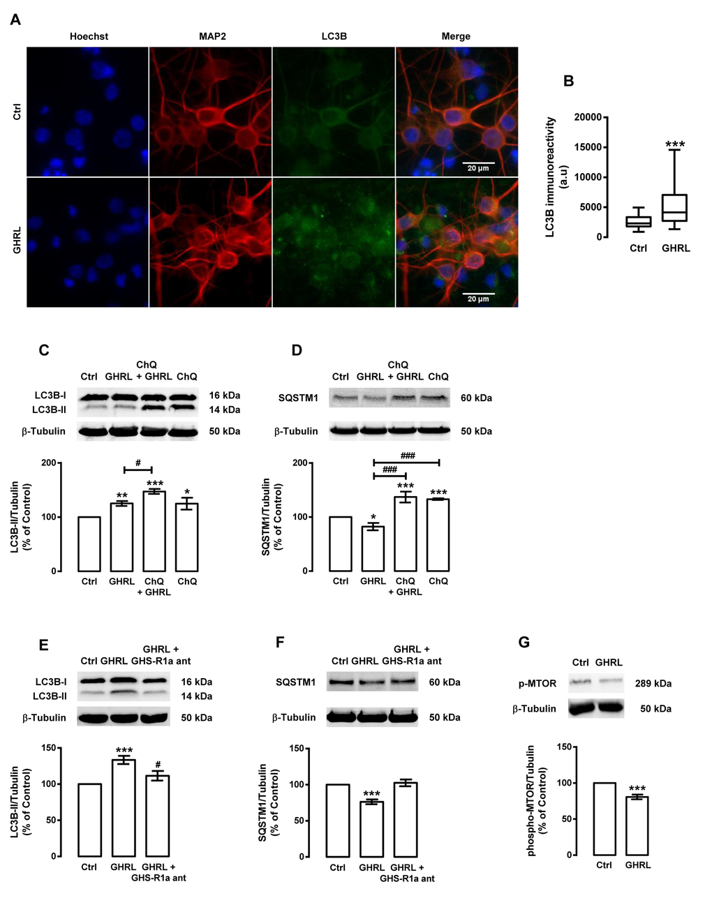 Ghrelin induces autophagy in rat cortical neurons. Primary rat cortical neurons were exposed to ghrelin (GHRL, 10 nM) for 6 h. Untreated cells were used as control (Ctrl). (A) LC3B cellular distribution was assessed by immunocytochemistry assay, as described in Materials and Methods. Cells were immunolabeled for LC3B (green) and MAP2 (red, neurons). Nuclei were stained with Hoechst 33342 (blue). Figures are representative of three independents experiments. Scale bar, 20 μM. (B) Quantification of the number of LC3B puncta immunoreactivity (green) per cell in each condition (>20 cells per group). ***pC-G) Cells were incubated with chloroquine (ChQ, 100 μM), a lysosomal degradation inhibitor (C and D) or GHS-R1a receptor antagonist [D-Lys3]-GHRP-6 (GHS-R1a ant, 100 μM) (E and F), 30 min before ghrelin (GHRL, 10 nM) treatment for 6 h. Whole cell extracts were assayed for LC3B-II (C and E), SQSTM1 (D and F), phospho-MTOR (p-MTOR) (G) and β-tubulin (loading control) immunoreactivity through Western blotting analysis, as described in Materials and Methods. Representative Western blots for each protein are presented above each respective graph. The results represent the mean ± SEM of, at least, five independents experiments, and are expressed as percentage of control. *p#p###p