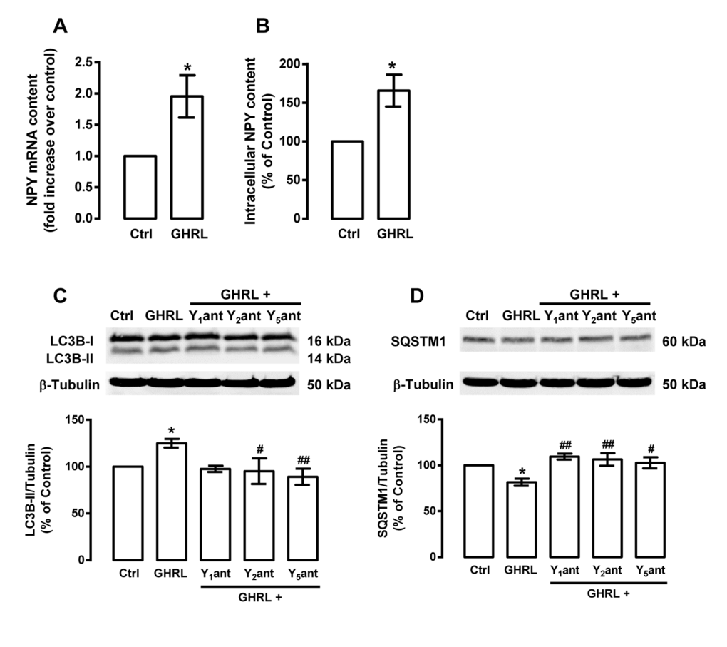 Ghrelin increases NPY content and NPY receptor antagonists block the stimulatory role of ghrelin on autophagy in rat cortical neurons. Primary rat cortical neuronal cultures were exposed to ghrelin (GHRL, 10 nM) for 6 h. Untreated cells were used as control (Ctrl). (A) Total RNA was isolated and the transcript levels of NPY were analyzed by qPCR, as described in Materials and Methods. The results represent the mean ± SEM of five independents experiments and are expressed as the relative amount compared to control. *pB) Ghrelin leads to increased NPY protein content, using an Enzyme-Linked Immunosorbent Assay, as described in Material and Methods. The results represent the mean ± SEM of three independents experiments and are expressed as the relative amount compared to control. (C and D) Cells were incubated with NPY Y1 receptor antagonist BIBP3226 (Y1ant, 1 μM), NPY Y2 receptor antagonist BIIE0246 (Y2ant, 1 μM) or NPY Y5 receptor antagonist L152,800 (Y5ant, 1 μM), 30 min before ghrelin (GHRL, 10 nM) treatment for 6 h. Whole cell extracts were assayed for LC3B-II (C), SQSTM1 (D) and β-tubulin (loading control) immunoreactivity through Western blotting analysis, as described in Materials and Methods. Representative Western blots for each protein are presented above each respective graph. The results represent the mean ± SEM of, at least, five independents experiments, and are expressed as percentage of control. *p#p##p
