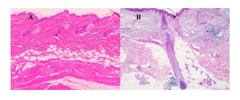 Typical layered dWAT structures in rodents and humans. (A) Section of the dWAT from the C57/BI6 mouse. This dWAT depot has the layered form placed parallel to the panniculus carnosus. (B) Human dermal adipocytes in the form of “dermal cones” around the pilosebaceous units. Single “dermal cones” can protrude into the upper dermis. These dermal cones are connected on the other end with sWAT. Pictures courtesy of Drs. Min Kim (A) and Travis Vandergriff (B), UT Southwestern Medical Center and published in [32].