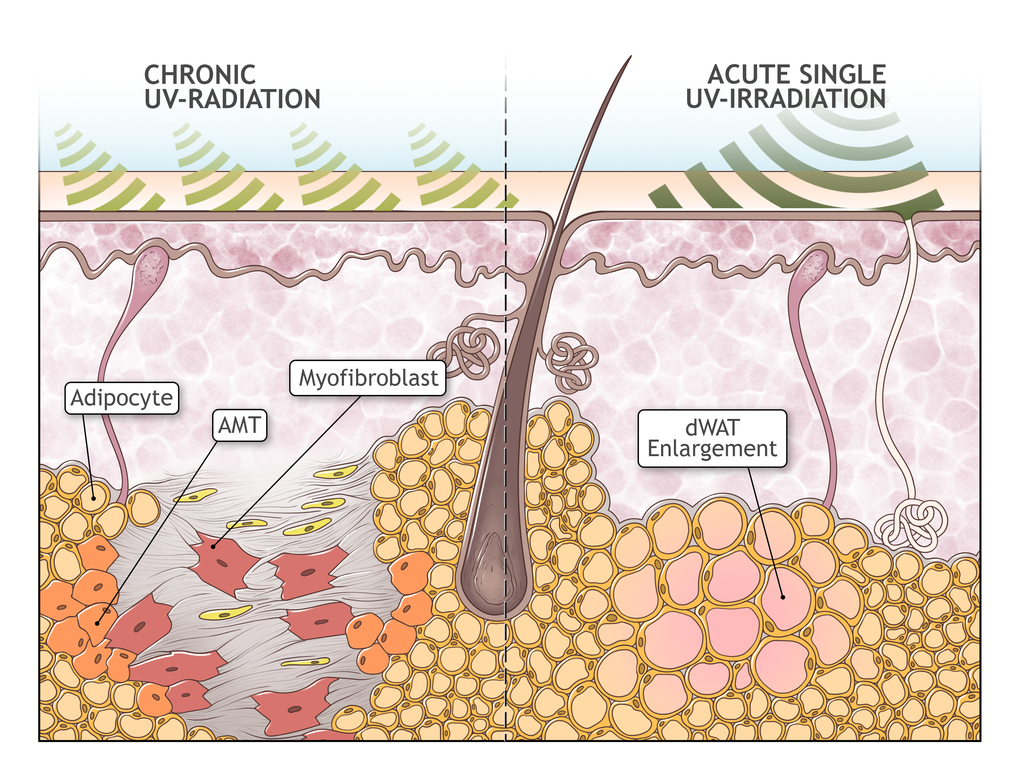 adipose tissue in skin