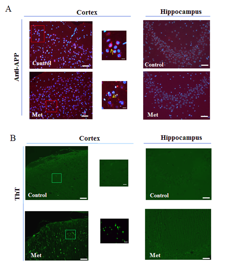Metformin induces accumulation of Aβ aggregates. (a) Immunofluorescence of cerebral cortex and hippocampus sections of metformin treated mice stained using anti-APP. Nuclei were stained with Hoechst 33258 and merged images with anti-APP staining are shown. (b) ThT staining of Aβ aggregates on coronary sections. High magnification of the squared areas is shown. Yellow arrows in the zoomed images indicate diffuse or punctate anti-APP staining. 20X original magnification. Scale bars = 50 μm and 5 μm in the zoomed images. n=5 per group