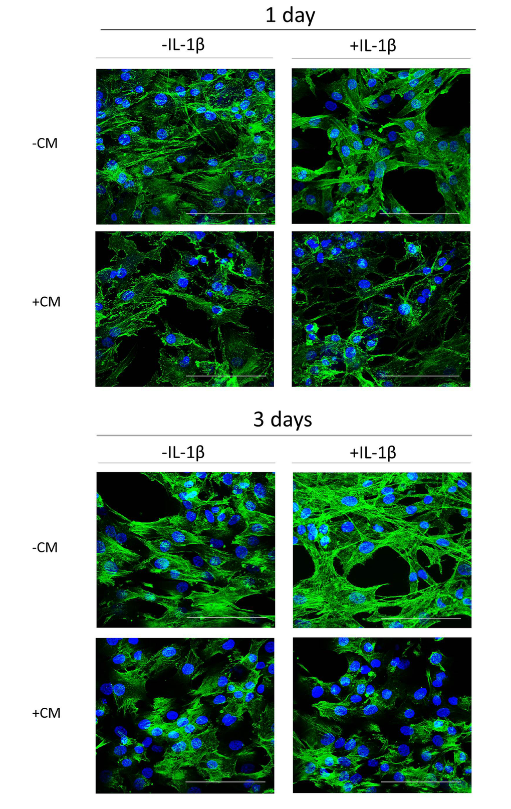 Actin stress fibers formation induced by IL-1β in OA chondrocytes and effect of CM. Presence of actin stress fibers (green pixels) in a representative experiment of N=4 separate experiments with cells from separate donors. DAPI was used to stain the nuclei. Bars: 50 μm. OA chondrocytes were incubated with IL-1β and/or CM for 1 day and 3 days.