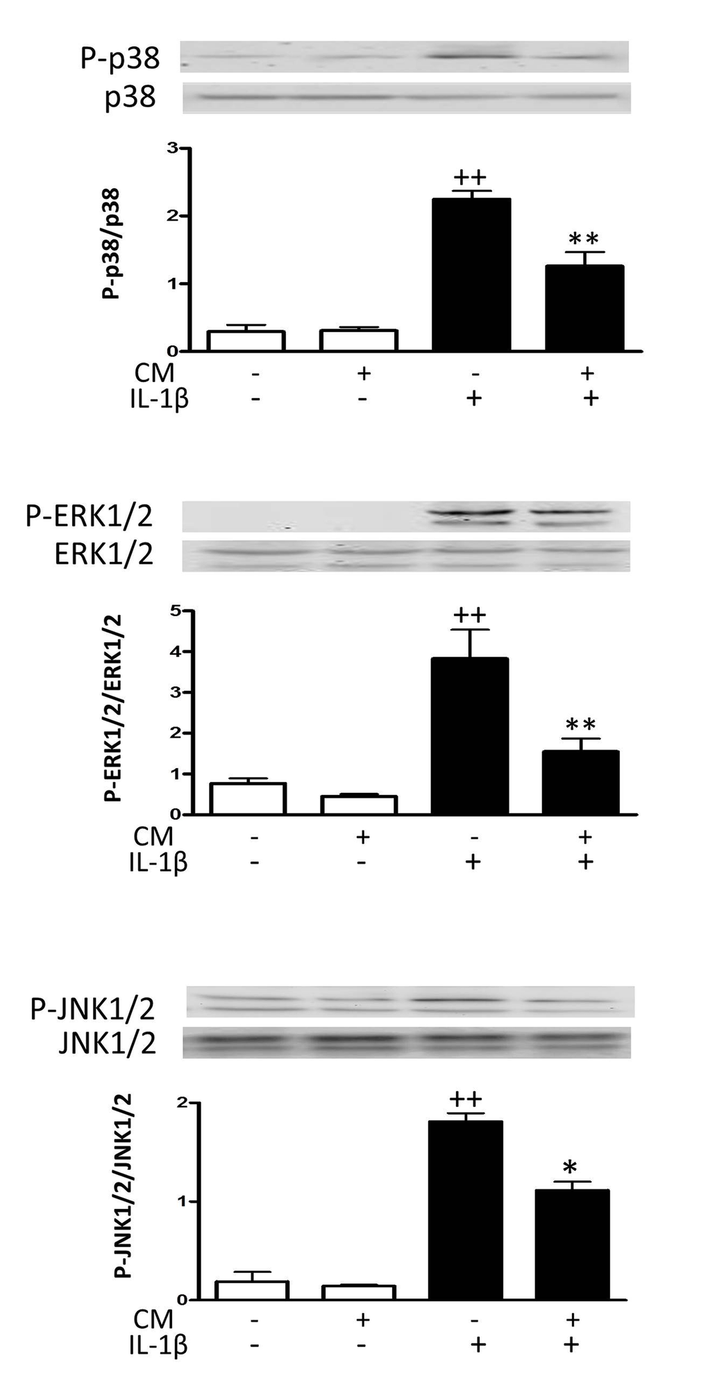 Effect of CM on MAPK. OA chondrocytes were incubated with IL-1β and/or CM for 15 min and immunoblotting was performed for phosphorylated and total p38, ERK1/2 and JNK1/2. Data are shown as mean±standard deviation of N=3 separate experiments with cells from separate donors. ++p