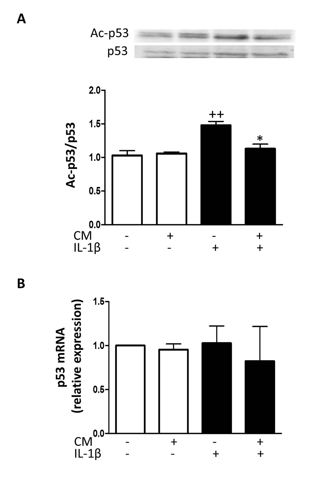 Effect of CM on p53. (A) Immunoblotting was performed for acetylated and total p53. (B) p53 mRNA expression was determined by quantitative real-time PCR. OA chondrocytes were incubated with IL-1β and/or CM for 24 hours. Data are shown as mean±standard deviation of N=4 separate experiments with cells from separate donors. ++p