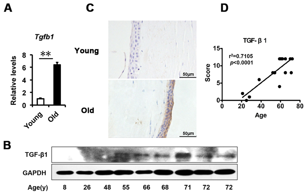 TGF-β1 excess in old donor corneal epithelium. (A) The mRNA expression of Tgfb1 in young donors and old donors corneal epithelium(**P≤0.01, n=3). (B) Immunoblot analysis of TGF-β1 in the corneal epithelium during aging. (C-D) Representative photographs (C) and histopathology scores (D) for the IHC staining of TGF-β1 in corneal epithelium from donors of different ages. There was a statistically significant difference in TGF-β1expression between the donors of younger than 30 years and older than 50years of age (P≤0.01). The figure depicts a Pearson correlation of TGF-β1 expression with age (D).