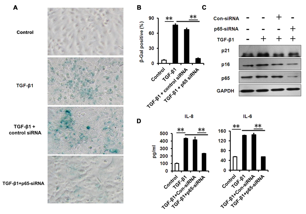 NF-κB p65-konckdown attenuates TGF-β1 induced senescence and SASP. (A-B) SA-β-Gal activity and the percentage of SA-β-gal-positive cells in HCECs treated with TGF-β1 for 3 days alone, or in combination with indicated siRNA. (C) Western blot analysis of p16 and p21 in HCECs treated with TGF-β1 for 3 days alone, or in combination with indicated siRNA. (D) The IL-6 and IL-8 in cultured HCECs supernatants were detected by ELISA. **P≤0.01. Data are representative of three independent experiments.