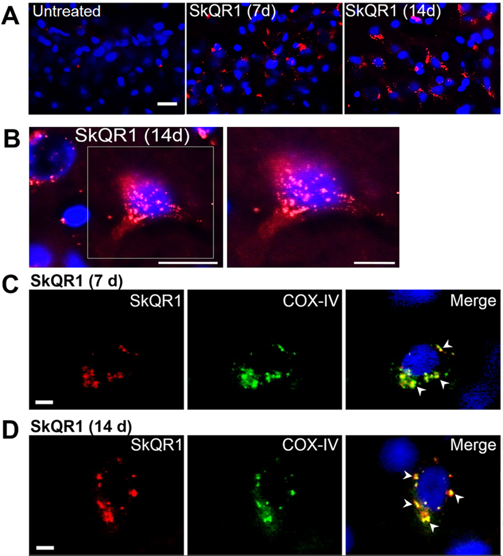 SkQ1 is predominantly localized to (and accumulates in) neuronal mitochondria. Four-month-old OXYS rats were treated with SkQR1 (250 nmol/kg) for 7 or 14 days (n = 4) to assess localization and accumulation of SkQ1. (A) High intensity of fluorescence signals of fluorescence signals of rhodamine-labeled of SkQ1 (red fluorescence) in neurons of the hippocampus in SkQR1-treated OXYS rats and the absence of specific signals in untreated (control) OXYS rats. The SkQR1 signal increased depending on the duration of treatment with the antioxidant (7 days B) An example of accumulation of SkQR1 (in red) in hippocampal neurons of an OXYS rat. (C and D) Immunolabeling with an anti-COX-IV antibody (mitochondrial loading control; in green) shows that SkQR1 (in red) is localized to neuronal mitochondria. The arrows show colocalization of SkQR1 and COX-IV. Cell nuclei are stained with DAPI (in blue). The scale bars are 20 µm (A and B) and 5 µm (C and D).