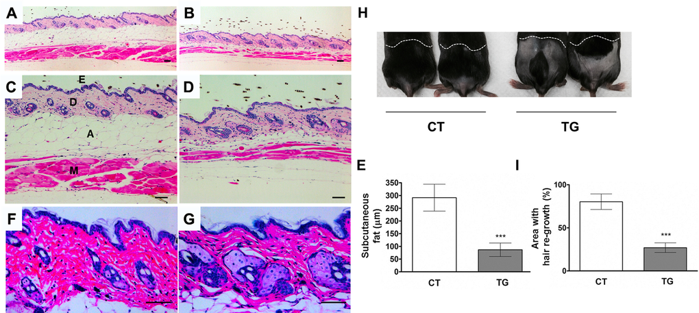 Cross-sections of dorsal skin from 20-week-old control (A, C, and F) and COX2 transgenic (B, D, and G) female littermates. Epidermis (E), dermis (D), adipose under the dermis (A), and muscle (M) are indicated. The COX2 transgenic skin exhibits sebaceous gland hyperplasia and a decrease in subcutaneous fat and muscle. Scale bar=100 μm (E) Quantification of the thickness of subcutaneous fat in control and COX2 transgenic mice (***: pH) A representative photo of 20- week-old COX2 transgenic and age-matched control male mice at 20 days after hair removal on dorsal area. (I) Quantification of hair re-growth in control and COX2 transgenic mice (***: p