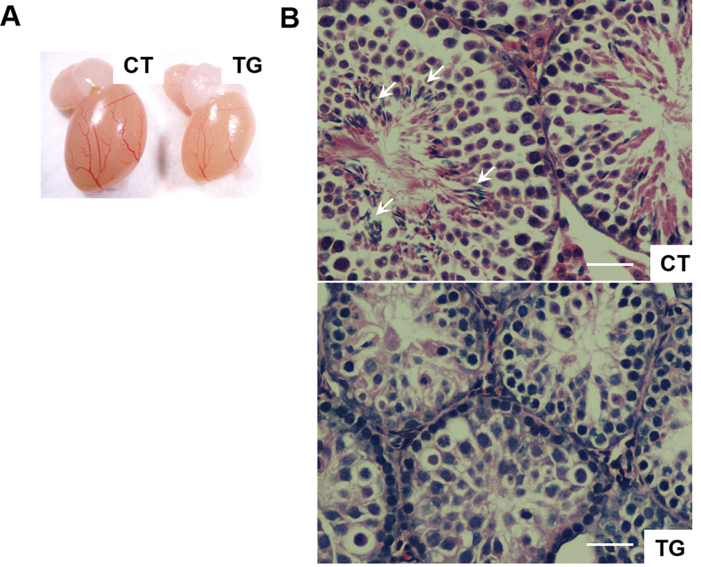 (A) A representative photo of testis from 23-week-old control (CT) and COX2 transgenic (TG) male littermates. The size of the testis is reduced in COX2 transgenic mice (n=4). (B) Cross-sections of testis from control (CT) and COX2 transgenic (TG) littermates at 25 weeks. While control testis contains sperms (arrows), sperms were not observed in COX2 transgenic testis. Scale bar=50 μm