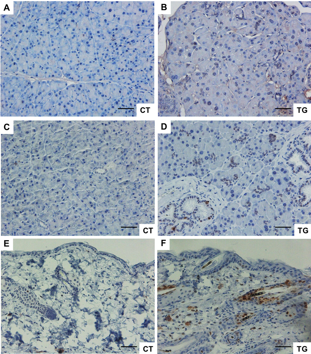 (A) and (B) Immunohistochemical staining of p16 in the pancreata from 25-week-old control and COX2 transgenic littermates (magnification x20). (C) and (D) Immunohistochemical staining of phospho-H2AX in the pancreata from 23-week-old control and COX2 transgenic littermates (magnification x20). (E) and (F) Immunohistochemical staining of phospho-H2AX in the skin from 25-week-old control and COX2 transgenic littermates (magnification x20). Scale bar=100 μm