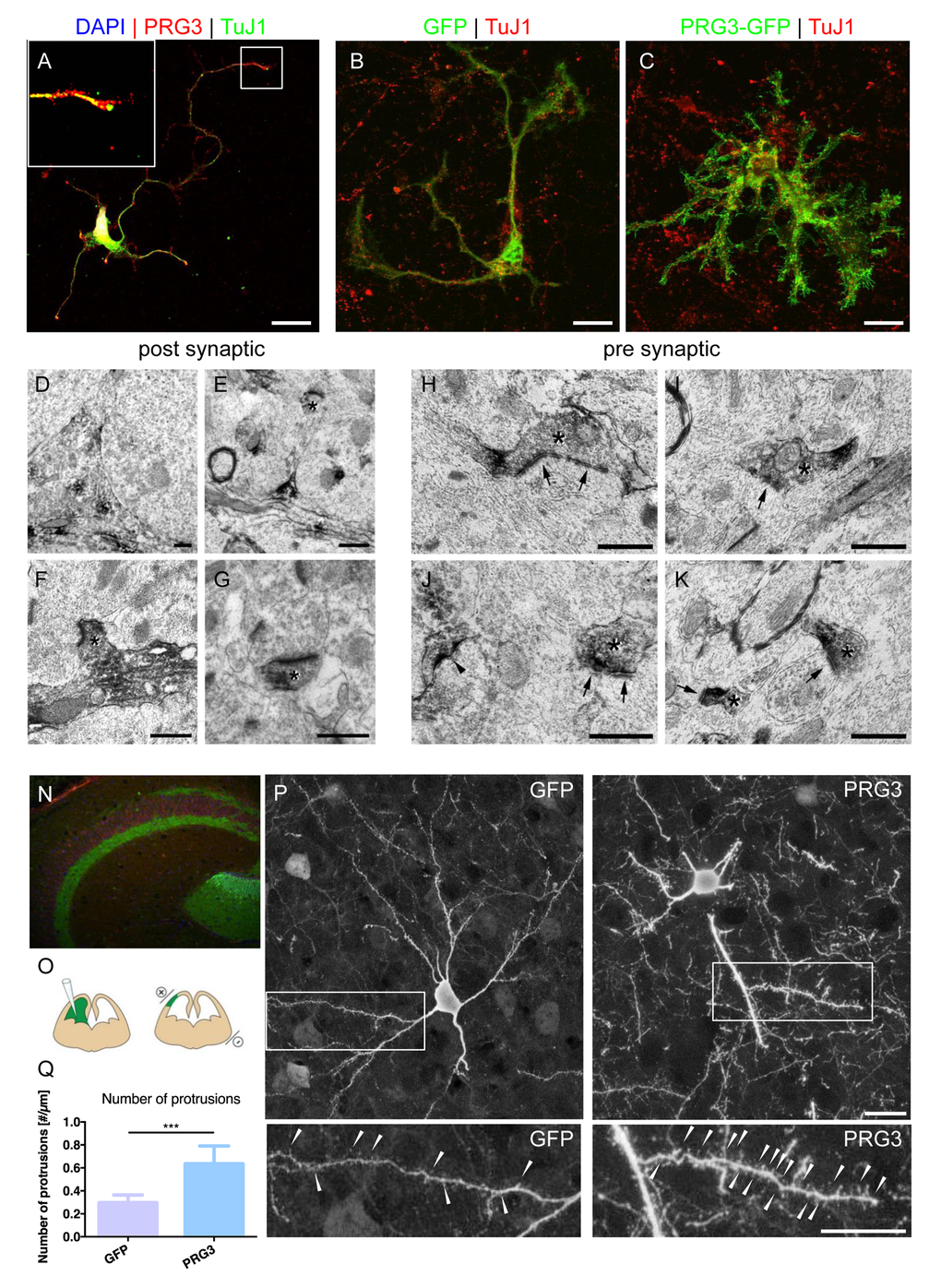 PRG3 is located at pre-synaptic domains in vitro and in vivo. (A) Endogenous PRG3 (red colour) is located at the plasma membrane and accumulated in TuJ1 positive axonal processes (green) in rat cortical neurons. Scale: 20 µm. (B) GFP vector transfection of rat primary cerebellar granular cells does not significantly alter cell morphology. TuJ1 co-staining shows neuronal origin (red). Scale: 20 µm (C) PRG3 overexpression (green) in primary cerebellar granular cells induces and accelerate neuronal outgrowth compared to controls (GFP, green). TuJ1immunostaining is given in red. Scale: 20 µm. (D-G) Pre-embedding electron microscopy immunolocalization of PRG3. Subcellular analysis reveals post-synaptic distribution of PRG3. DAB accumulated in the cytoplasm (D). Dendritic spine structures were also found positive for PRG3 and are indicated by asterisks (E-G). Scales: 0.5 µm. (H-K) Occasionally, axonal boutons (pre-synaptic structures), appeared labeled with PRG3 antibodies (asterisk). Accumulations of DAB appeared especially in the pre-terminal parts of the axonal boutons. Postsynaptic elements are marked with arrows and a labeled spine with an arrowhead in J. Scales: 0.5 µm. (N) Immunohistochemical staining identifies endogenous PRG3 expression (green) is located primarily in the hippocampus in the adult mouse brain (Red = TuJ1). (O) Scheme of the experimental protocol for cortical in utero electroporation [55]. (P) Representative example of electroporated brain section showing pyramidal neurons positive for GFP expressing pyramidal neurons (left) and PRG3-positive pyramidal cells (right). Neuronal morphology was analysed at postnatal day 10 (P10). Scale bar represents 20 µm. High-power magnifications of boxed areas show spines and spine-like membrane protrusions, which are indicated by arrowheads. Scale bar represents 20 µm. (Q) Number of protrusions per µm dendrite were quantified in 70 µm confocal stacks. Neurons electoroporated with PRG3 show significantly more protrusions per µm compared to GFP electroporated neurons. Values are given as mean ± SEM. (N=5). Statistical analysis was performed using two tailed student’s t-test. P value was set as * = p