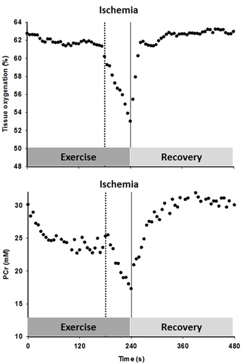 The effect of superimposing reactive hyperemia on the recovery from plantar flexion exercise on the relationship between microvascular partial pressure of O2 (PO2) and initial post exercise PCr resynthesis rate, an index of O2 utilization, in the context of diffusive and convective O2 transport. Muscle O2 utilization was inferred from the initial post exercise PCr resynthesis rate as this process is derived almost exclusively from oxidative phosphorylation [22]. Microvascular PO2 was derived from the tissue oxygen index [23], assuming that the near infrared spectroscopy signal mainly originates from hemoglobin [24], and then computed from the O2-hemoglobin dissociation curve [25]. Oxygen consumption, VO2; blood flow, Q; arterial oxygen content, CaO2; venous oxygen content, CvO2; diffusional conductance, DO2; Mean Capillary PO2, PCapO2.