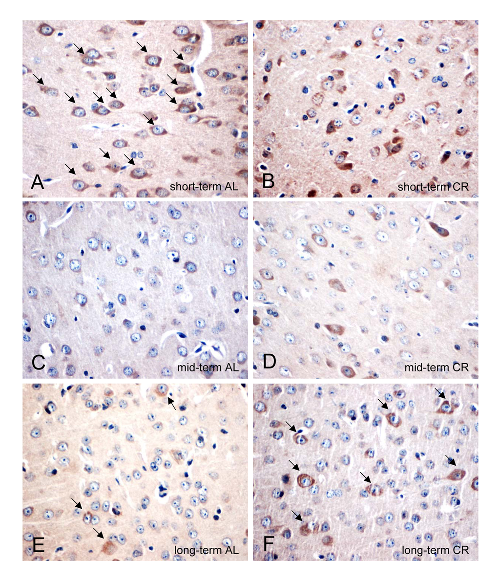 (A-F) Representative immunohistochemical images (original magnification x400) of PSD95 protein expression in brain of short-term (A and B), mid-term (C and D) and long-term (E and F) ad libitum- (AL, left panels) and caloric-restricted-fed (CR, right panels) ApoE-/- mice. Mice were fed either AL or CR (60% of ad libitum) for a short-term (4 weeks; n=14), mid-term (20 weeks; n=14) or long-term (64 weeks; n=14). Note the decrease of PSD95-positive neurons in the AL-fed ApoE-/- mice while a long-term CR delayed the decline of PSD95-positive neurons in the ApoE-/- mice (indicated by arrows).