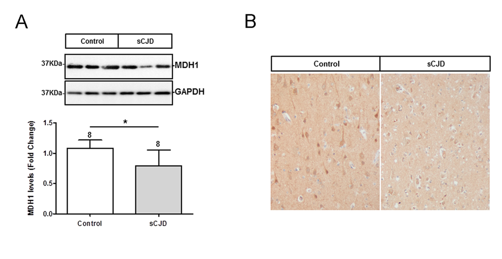 Determination of expression level and localization of MDH1 in brain tissue of CJD patients. (A) MDH1 was detected by western blot analysis in the frontal cortex region 8 of sCJD patients (n=8) in comparison to controls (n=8). Densitometric analysis of band intensities revealed a lower of MDH1 level in sCJD patients (MM1 and VV2). (B) Immunohistochemical staining using anti-MDH1 confirmed the decreased expression of MDH1 in sCJD (MM1) patients (n=5) compared to age-matched controls (n=4). For comparison between two groups we used the Wilcoxon Mann Whitney test. A p-value 