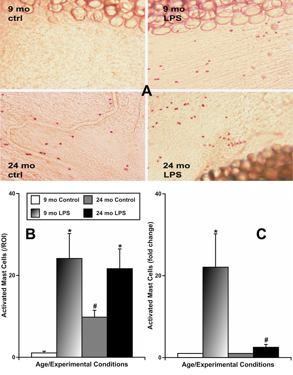 Effects of LPS-induced acute inflammation on activation of mast cells located in mesentery close to mesenteric lymphatic vessels in adult (9 mo, n=4 for control and n=4 for LPS-treated groups) and aged (24 mo, n=4 for control and n=4 for LPS-treated groups) rats. (A) representative images of activated mast cells stained by Ruthenium Red in sham (ctrl) and LPS-treated mesenteric segments of both ages; (B) comparison of number of activated mast cells per region of interest (ROI) under various conditions; (C) similar data normalized to control conditions for that age group to demonstrate the fold change in number of mast cells activated by LPS. * indicates significant differences (p 