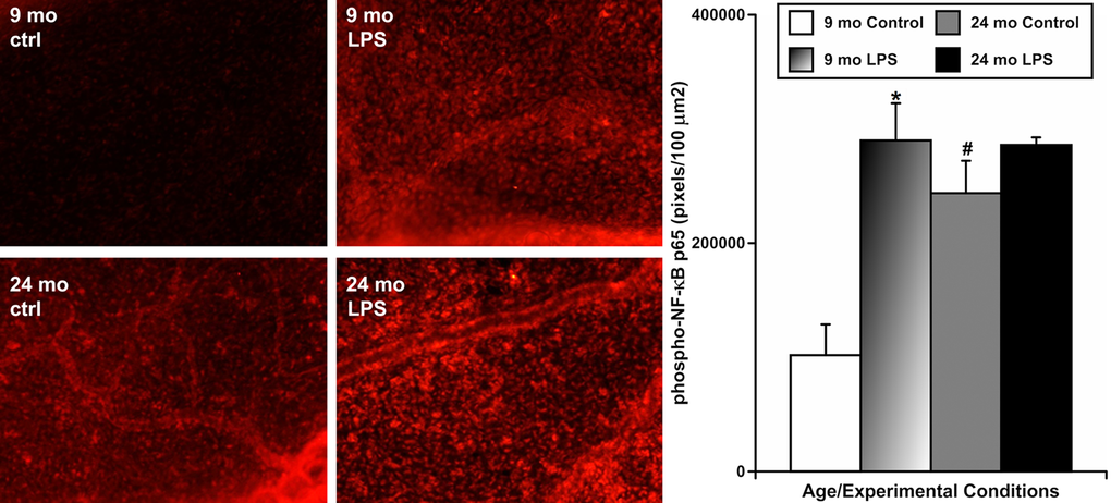 Effects of LPS-induced acute inflammation on activation of NF-κB signaling in mesentery close to mesenteric lymphatic vessels in adult (9 mo, n=4 for control and n=4 for LPS-treated groups) and aged (24 mo, n=4 for control and n=4 for LPS-treated groups) rats. Left panels – representative images of mesentery labeled for phospho-NF-κB p65 (in red) in sham (ctrl) and LPS-treated (LPS) mesenteric segments of both ages. The graph on the right shows a comparison of pixel intensity of phospho-NF-κB p65 per 100 μm2 under the various conditions. * indicates significant difference (p 