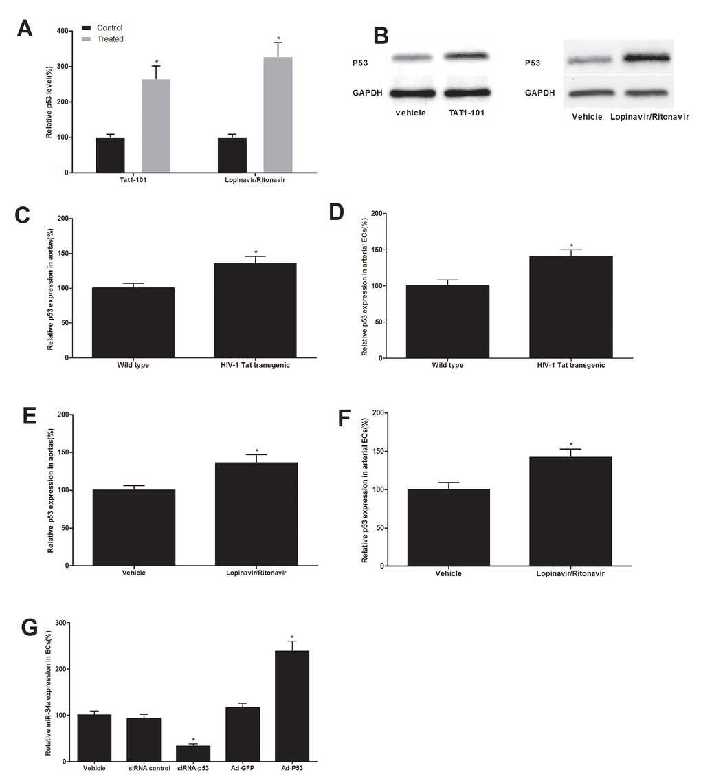 p53 is an upstream signaling molecule that is responsible for the up-regulation of miR-34a in both HIV-Tat protein and antiretroviral agents-treated ECs and vessels. The expression of p53 was increased in ECs treated with Tat1-101 or lopinavir/ritonavir (A and B). The expression of p53 was also increased in vascular walls and their ECs from HIV-1 Tat transgenic mice (C and D) and from mice with antiretroviral therapy in vivo (E and F). The expression of miR-34a was decreased by p53 knockdown, but was increased by p53 over expression (G). Note: n=6; *p