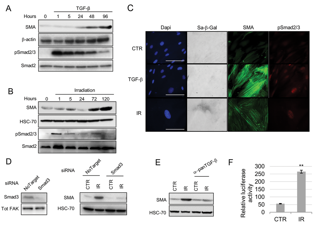 Smad signaling mediates senescence induction of a myofibroblastic phenotype. Western blot showing SMA and phospho(p)-Smad2/3 expression following treatment of HFFF2 fibroblasts with TGF-β1 (A) or irradiation (B) (Smad2 and HSC-70 as loading controls). (C) Representative images of immunofluorescence on HFFF2 fibroblasts showing expression of SMA (green), pSmad2/3 (red), SA-β-Galactosidase activity (grey; in bright field) with DAPI nuclear counterstain (Blue) (scale bar indicates 100µm). (D) Western blots showing SMAD3 knock-down (Tot-FAK as loading control) (left) and SMA expression (HSC-70 as loading control; right) in irradiated HFFF2 cells. (E) Western blot for SMA expression in irradiated HFFF2 pre-treated with a pan TGF-β1 inhibitory antibody. (F) TGFβ-1 assay showing luciferase activity controlled by a TGFβ-1 responsive promoter in MLEC cells co-cultured for 24 hours with untreated or irradiated fibroblasts (y axis indicates the ratio between luciferase activity and HFFF2s protein concentration). Data are presented as mean ± SEM and statistics are shown for T-test compared to controls. See also Supplementary Fig. S3.