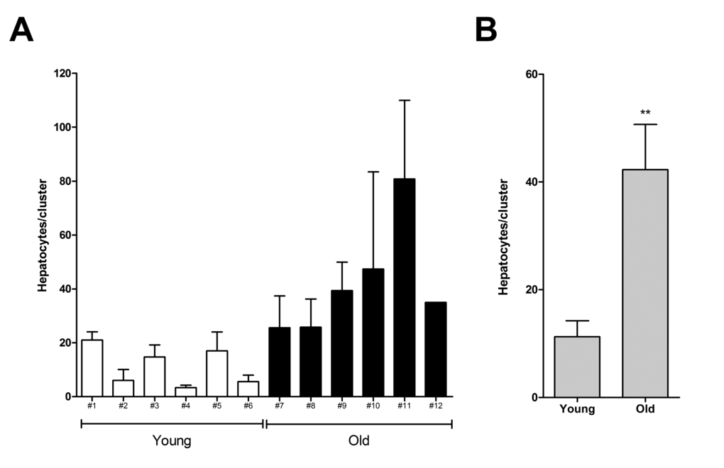 Size of donor-derived, pre-neoplastic hepatocyte clusters in animals transplanted at young or old age and killed 3 months after Tx (see Experimental procedures for details). Panel (A) mean cluster size (± SE) in individual animals. Panel (B) mean cluster size per group. Data are mean ± SE; **significantly different from young group:P
