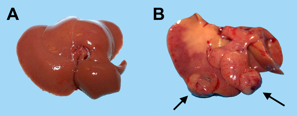 Macroscopic appearance of livers from animals transplanted with pre-neoplastic hepatocytes in at young or old age and killed 8 months after Tx. Panel (A) liver from a rat transplanted at 5 months of age and killed 8 months later: liver surface is regularly smooth and no lesions were detected. Panel (B) liver from a rat transplanted at 20 months of age and killed 8 months later: note the presence of two large nodules with prominent vasculature (arrows).