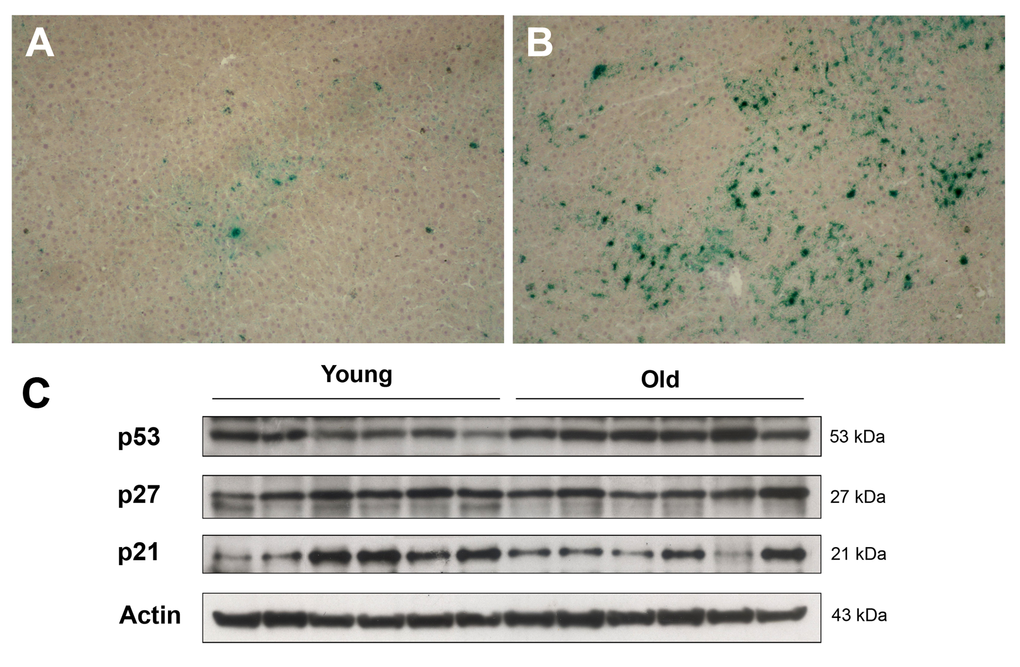 Panels (A) and (B) Expression of SA-β-gal in the liver of animals transplanted with pre-neoplastic hepatocytes in at young or old age and killed 3 months after Tx. The senescence marker was diffusely expressed in aged animals (panel B), while it was a rare finding in liver samples from young rats (panel A). Panel (C) Western Blot analysis of p21, p27 and p53 in liver samples from young and old recipients.