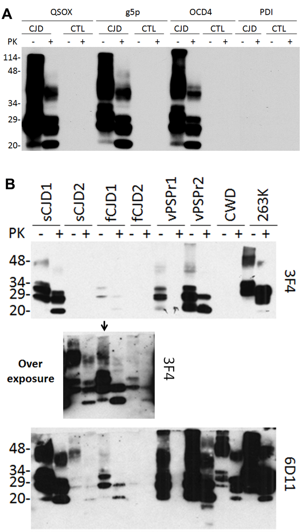 Western blotting of PrP captured by QSOX. (A) PrP eluted from the QSOX-conjugated beads was detected by Western blotting with the anti-PrP antibody 3F4. The g5p-beads and OCD4-beads were used as controls while the PDI beads served as a negative control. Like g5p and OCD4, QSOX captures PrP only from CJD but not from non-CJD control brain homogenate. (B) PrP was captured by the QSOX beads from brain homogenates of two sCJD cases (sCJD1 and sCJD2), two cases with different genetic prion diseases (fCJD1 and fCJD2), two cases with VPSPr (Variably protease-sensitive prionopathy) (VPSPr1 and VPSPr2), CWD and hamster 263K. PrPSc captured from sCJD2 and fCJD2 was detectable by 3F4 only on the overexposed film (middle panel shows the overexposed part of the above blot containing samples from sCJD2, fCJD1 and fCJD2). The blots were probed with the 3F4 and 6D11 antibodies and they are a representative of three experiments.
