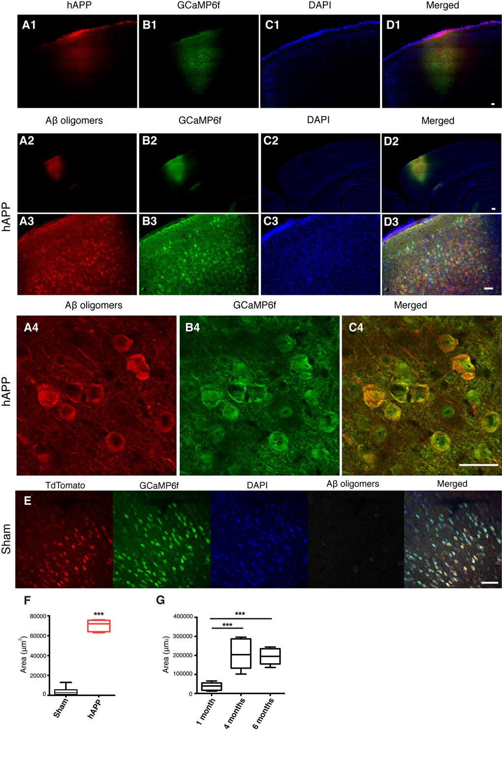 Detection of hAPP and Aβ oligomers in the PFC at 1 mpi of AAV-hAPP-SLA in WT mice.In vivo detection of hAPP (A1), Aβ oligomers (A2-A4), GCaMP6f (B), DAPI (C) and merged (D). Immunofluorescence images at low (1, 2), medium (3) and high (4) magnification. Scale bars = (1) 100 µm, (2, 3) 200 µm and (4) 50 µm. (E) Aβ oligomers were not detected in sham mice injected with the control vector AAV-tdTomato. Scale bar = 50 µm. (F) Quantification of Aβ oligomer diffusion in sham and hAPP mice. (G) Quantification of Aβ oligomer diffusion in hAPP mice at three different timepoints. (Student’s test, P 