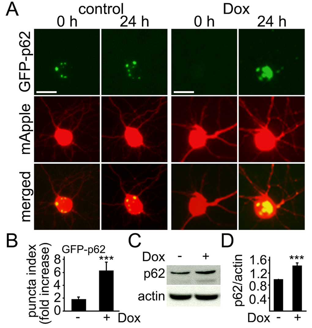Levels of p62 increase in cultured cortical neurons treated with doxorubicin. (A) Autophagy was impaired by doxorubicin. Cortical neurons were transfected with mApple (a morphology and viability marker) and GFP-p62. The first neuronal cohort was treated with a vehicle, and the second cohort was treated with 50 nM doxorubicin (overnight). Neurons were imaged before and after the treatments. Small aggresomes are sometimes formed in neurons. Note large inclusion bodies formed by GFP-p62 in doxorubicin-treated neurons. Bar, 10 μm. (B) Quantification of fluorescent images from (A). The fold-increase of the puncta index in neurons, which express GFP-p62, treated with a vehicle or with 50 nM doxorubicin (overnight). *** pC) Endogenous p62 accumulated in cultured cortical neurons treated with 50 nM doxorubicin (overnight). Actin was used as a loading control. (D) Quantification of western blots from (C). The levels of p62 were normalized to actin. *** p