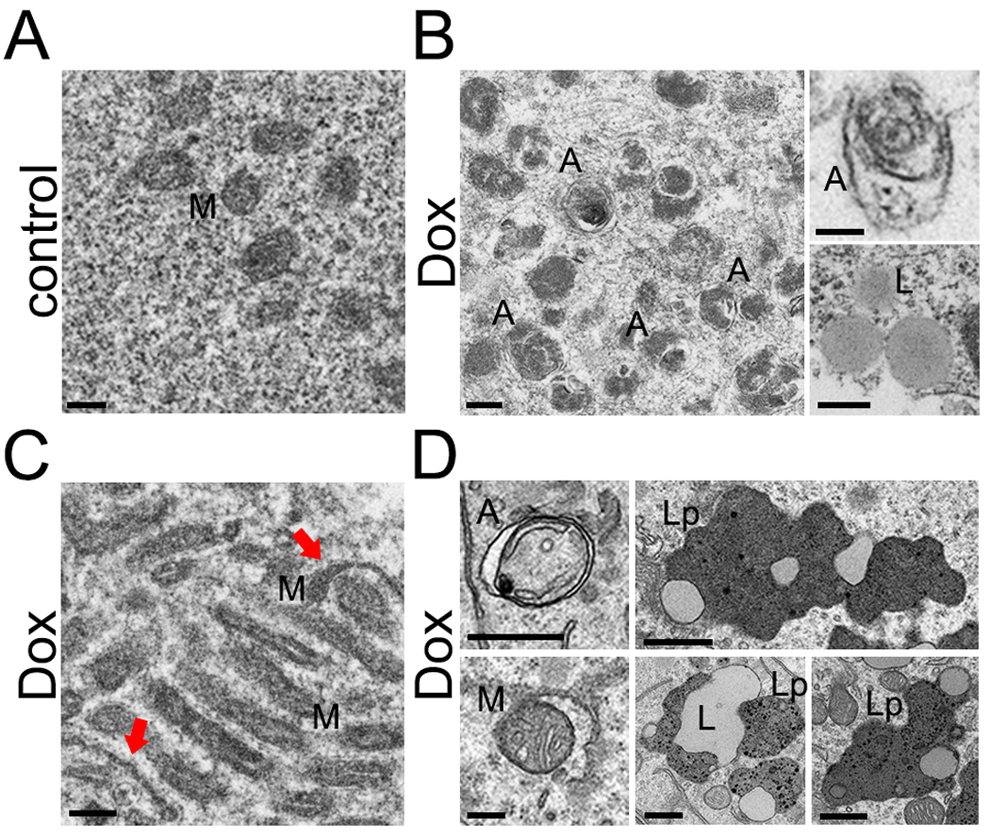 Accumulation of autophagosomes and organelles in primary cultured neurons and mouse brains induced by doxorubicin and doxil, respectively. (A) An example of an electron micrograph of cultured cortical neurons treated with a vehicle (overnight). M, mitochondria. Bar, 200 nm. (B) Electron micrographs of cultured cortical neurons treated with 50 nM doxorubicin (overnight). Left panel: A, autophagosomes. Bar, 200 nm. Right upper panel: A, an autophagosome. Bar, 100 nm. Right lower panel: L, lipid droplets. Bar, 500 nm. (C) An example of an electron micrograph of cultured cortical neurons treated with 50 nM doxorubicin (overnight). Note an abnormally large cluster of mitochondria. Arrows note atypical mitochondria. Bar, 200 nm. (D) Electron micrographs of mouse brain exposed to doxil. Left panels: A, autophagosomes. M, a mitochondrion being engulfed by an autophagosome. Bar, 200 nm. Right panels: L, lipid droplets; Lp, lipofuscin. Bar, 500 nm.