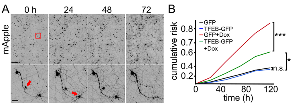 TFEB increases survival of doxorubicin-treated neurons. (A) An example of longitudinal imaging and survival analysis. Primary cortical neurons transfected with mApple were followed with an automated microscope. Images collected every 24 h demonstrate the ability to return to the same field of neurons and track them over time. Each image is a montage of images captured in the center of one well of a 24- or 96-well plate. Scale bar is 400 μm. In the lower panel, images are zoomed in. Arrows represent two neurons that degenerate over time. Scale bar is 50 µm. (B) Two cohorts of primary cortical neurons transfected with mApple + GFP were treated either with a vehicle or 10 nM doxorubicin. Two cohorts transfected with mApple + TFEB-GFP were treated either with a vehicle or 10 nM doxorubicin. 16 hours after treatment, the four cohorts of neurons were imaged and tracked over 5 days. Risk of death associated with doxorubicin was calculated with JMP software. *p