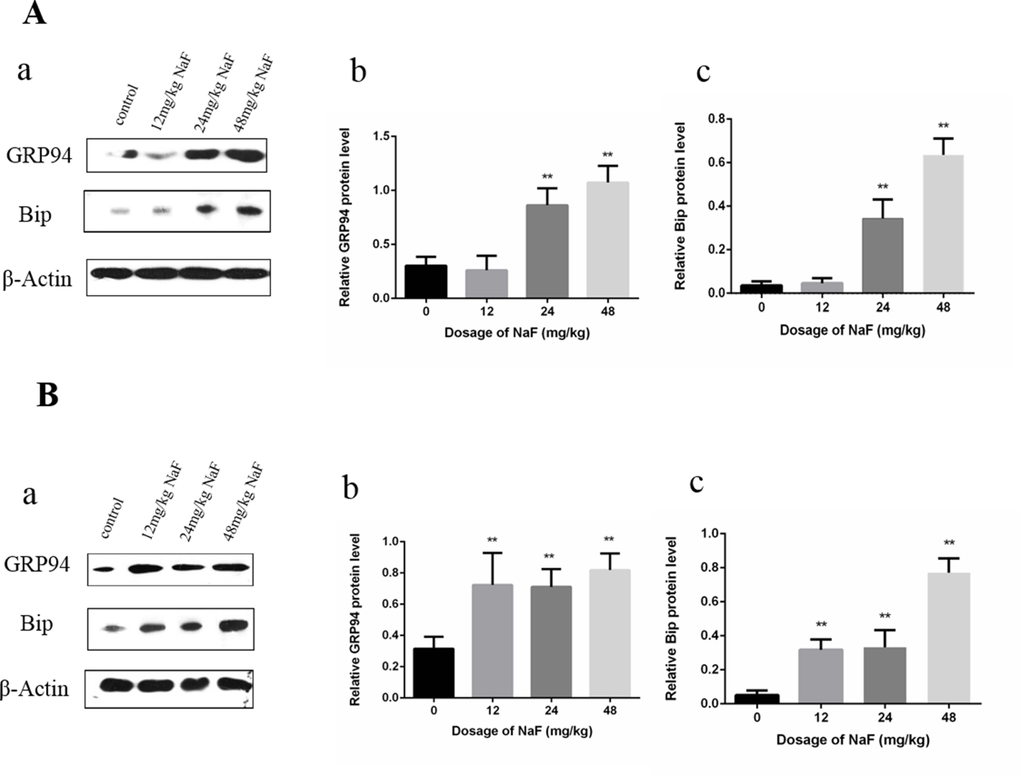 Effect of NaF on ER stress-related proteins in the spleen at 21 (A) and 42 (B) days of age. (a) The western blot assay. (b-c) Quantitative analysis of protein expression. Data are presented with the means ± standard deviation, * p p 
