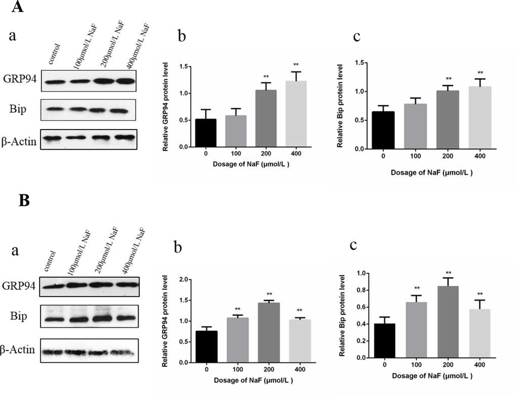 Effect of NaF on protein expression levels of GRP94 and Bip in cultured splenic lymphocytes at 24 h (A) and 48 h (B). (a) The western blot assay. (b-c) Quantitative analysis of protein expression. Data are presented with the means ± standard deviation, * p p 