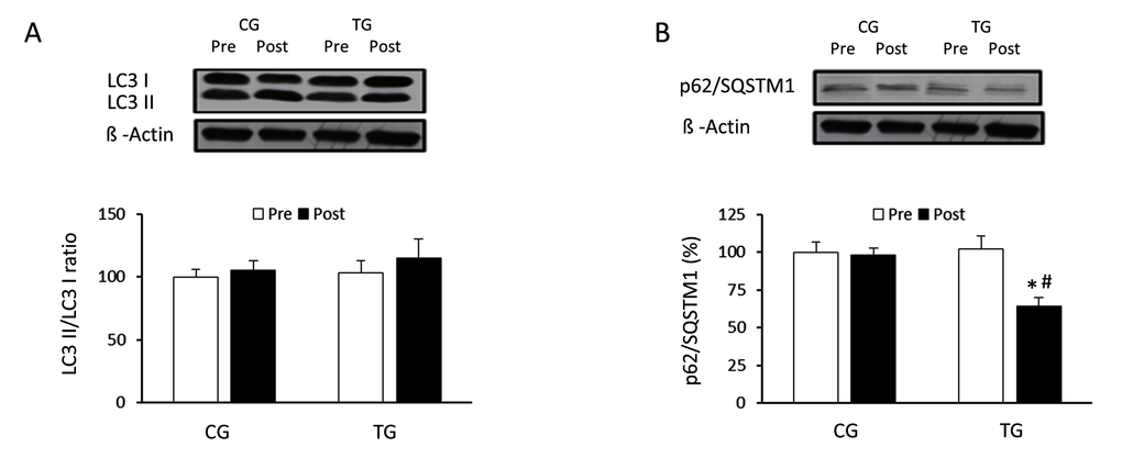 Effects of resistance training on LC3I, LC3II and p62/SQSTM1 expression. Representative Western blots and densitometric quantification of LC3II, LC3I (A) and p62/SQSTM1 (B) in response to 8 weeks of resistance training for TG and the same period of normal daily routines for CG. Protein from PBMCs was separated by sodium dodecyl sulfate-polyacrylamide gel electrophoresis, followed by immunoblotting. Equal loading of proteins is illustrated by β-actin bands. Values are means ± SEM.*pvs. CG; #p vs. Pre within a group.