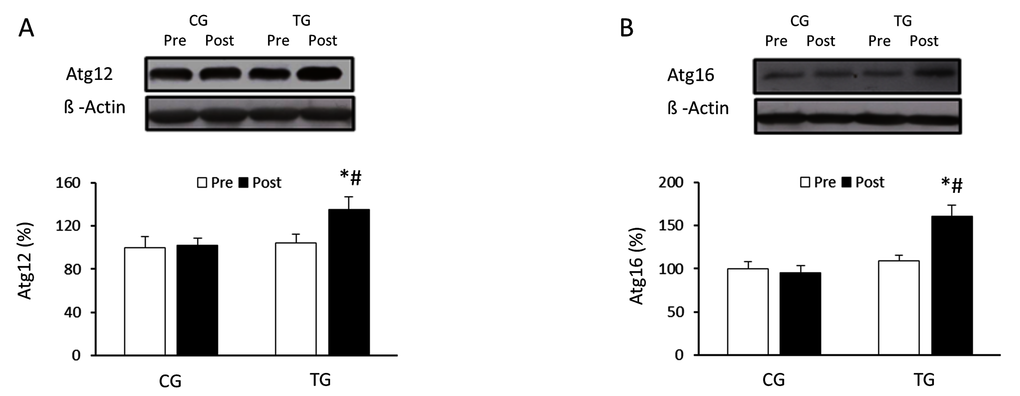 Effects of resistance training on Atg12 and Atg16 expression. Representative Western blots and densitometric quantification of Atg12 (A) and Atg16 (B) in response to 8 weeks of resistance training for TG and the same period of normal daily routines for CG. Protein from PBMCs was separated by sodium dodecyl sulfate-polyacrylamide gel electrophoresis, followed by immunoblotting. Equal loading of proteins is illustrated by β-actin bands. Values are means ± SEM.*pvs. CG; #p vs. Pre within a group.