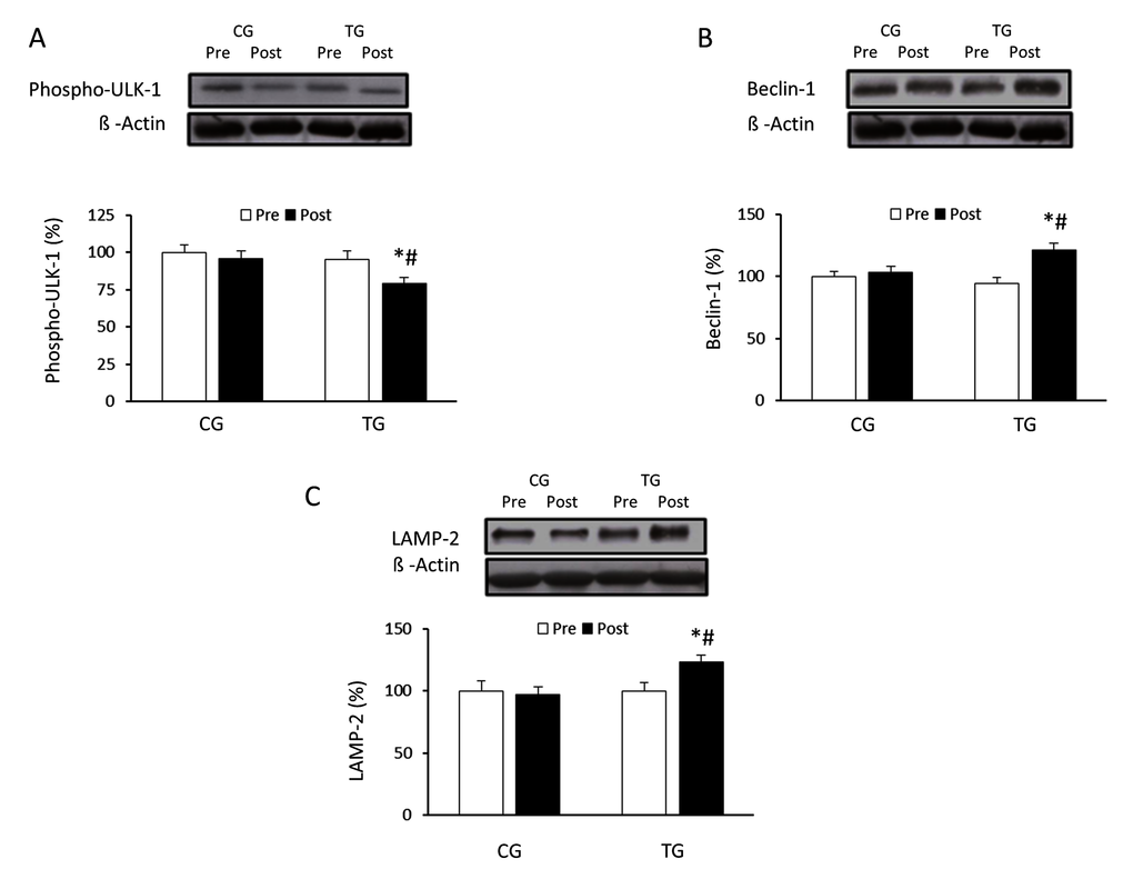 Effects of resistance training on Ser757 phospho-ULK-1, beclin-1 and LAMP-2 expression. Representative Western blots and densitometric quantification of Ser757 phospho-ULK-1 (A), beclin-1 (B) and LAMP-2 (C) in PBMCs in response to 8 weeks of resistance training for TG and the same period of normal daily routines for CG. Protein from PBMCs was separated by sodium dodecyl sulfate-polyacrylamide gel electrophoresis, followed by immunoblotting. Equal loading of proteins is illustrated by β-actin bands. Values are means ± SEM.*pvs. CG; #pvs. Pre within a group.