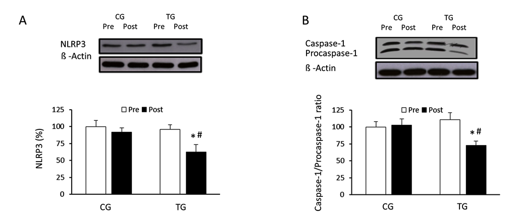Effects of resistance training on NLRP3 inflammasome expression and caspase-1/procaspase-1 ratio. Representative Western blots and densitometric quantification of NLRP3 (A), caspase-1 and procaspase-1 (B) in PBMCs in response to 8 weeks of resistance training for TG and the same period of normal daily routines for CG. Protein from PBMCs was separated by sodium dodecyl sulfate-polyacrylamide gel electrophoresis, followed by immunoblotting. Equal loading of proteins is illustrated by β-actin bands. Values are means ± SEM.*pvs. CG; #pvs. Pre within a group.