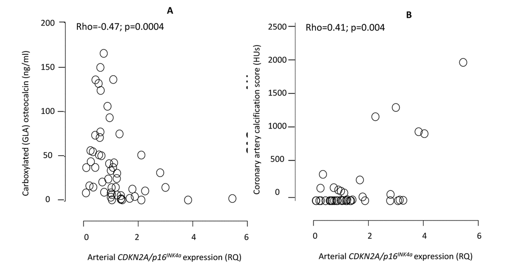 CDKN2A/p16INK4a expression is associated with vascular progeria in 