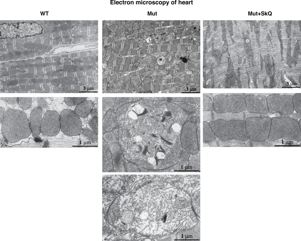 Heart mitochondrial structure. Electron micrographs of heart from wild-type mice (left panel), mtDNA mutator mice (middle panel) and mtDNA mutator mice treated with SkQ1 (right panel). Animals were 245 – 252 days old. Similar findings were observed in 4-5 other mice of each group.
