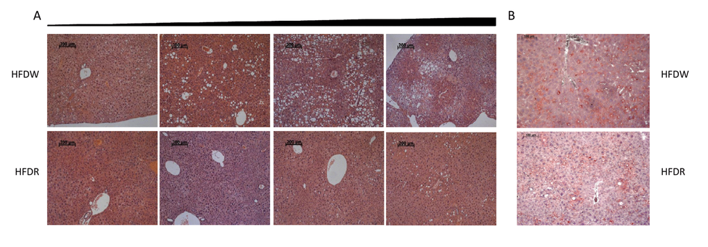 Rapamycin prevents development of HFD-induced hepatic steatosis in male mice. (A) H&E staining of representative liver sections graded from the least affected (left) to the worst affected (right) within each group. (B) Representative oil-red O stained sections of livers. HFDW – mice fed with HFD; HFDR – mice received HFD in combination with rapamycin.