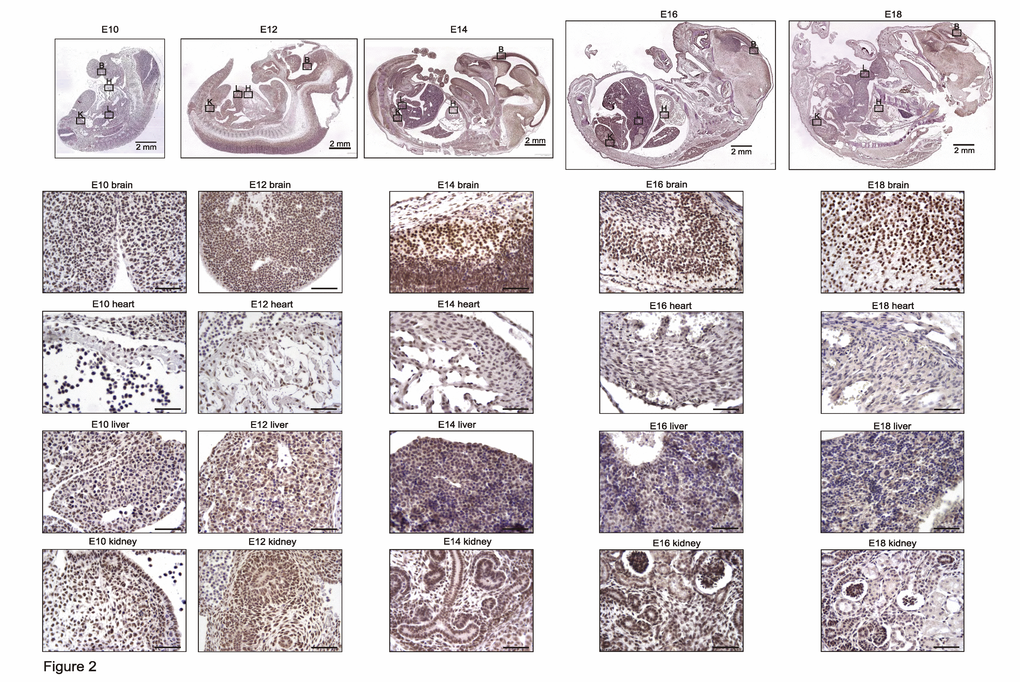 TRF2 is highly and ubiquitously expressed during embryonic development up to E16 and persists afterwards specifically in the brain. Representative photomicrographs of TRF2 immunostaining on sections of mouse embryos (3,3' diaminobenzidine (DAB) substrate, brown, hematoxylin counterstaining) at different stages before birth. B: brain, H: heart, L: liver, K: kidney. Unless otherwise indicated, scale bars represent 50µm.